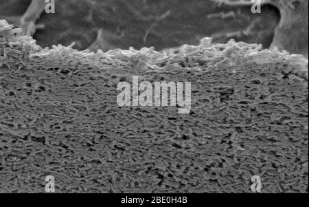 Scanning electron micrograph (SEM) of Clostridium difficile (long cell ...