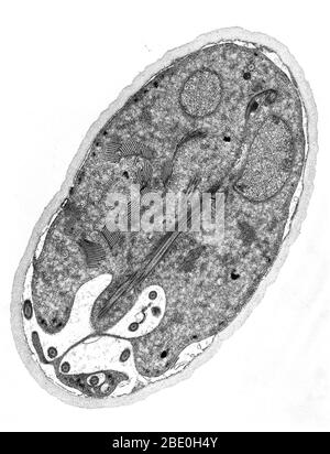 Transmission Electron Micrograph (TEM) showing the cyst-stage of a Giardia sp. protozoan. The outer cyst wall is composed of filamentous and membranous portions, and is separated from the cytoplasm of the trophozoites contained within by the peritrophic space. This cyst wall is approximately 0.25 microns thick. Stock Photo