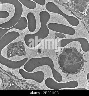 Transmission Electron Micrograph (TEM) of blood sample, showing red blood cells, platelet and white blood cell (lymphocyte). Magnification unknown.