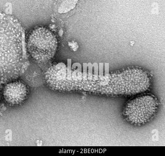 Negative stain Transmission Electron Micrograph (TEM) of the Influenza A (H1N1) virus, PR8 strain. Magnification unknown.