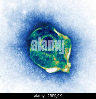 Color enhanced transmission electron micrograph (TEM) of the Herpes Simplex Virus. Stock Photo