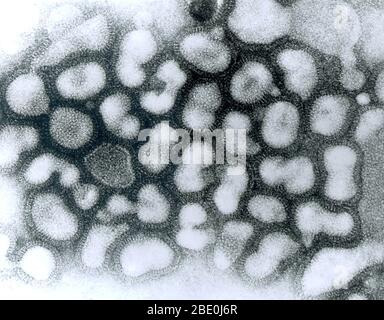 Transmission electron micrograph (TEM) of influenza A virus.