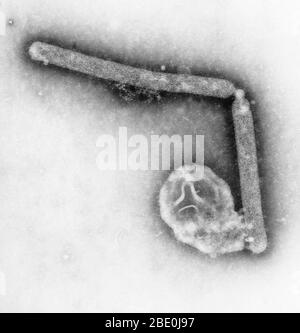 Transmission Electron Micrograph (TEM), revealing the ultrastructural details of two avian influenza A (H5N1) virions, a type of bird flu virus, which is a subtype of avian influenza A. At this magnification, one may note the stippled appearance of the roughened surface of the proteinaceous coat encasing each virion. Although this virus does not typically infect humans, in 1997, the first instance of direct bird-to-human spread of influenza A (H5N1) virus was documented during an outbreak of avian influenza among poultry in Hong Kong. The virus caused severe respiratory illness in 18 people, o
