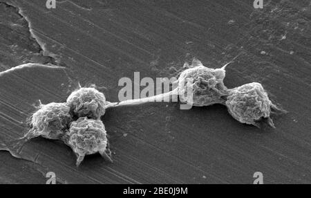 Free-living amoebae (FLA) in the Amoebozoa group are important causes of disease in humans and animals. Scanning Electron Micrograph (SEM) of a laboratory-grown potable (drinking) water biofilm, with the presence of Vermamoeba vermiformis (Hartmanella) cysts. Aquatic bacteria were grown as biofilm on steel for one week. V. vermiformis were then added, and phagocytized the bacteria that multiplied within vesicles that became cysts in which the bacteria will live until they rupture. Vermamoeba vermiformis a free-living amoeba (FLA), is widespread in nature and has been isolated from soil, freshw Stock Photo