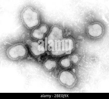 Negative-stained Transmission Electron Micrograph (TEM) showing you a number of Influenza A virions. Influenza A virus causes influenza in birds and some mammals, and is the only species of influenza virus A. Influenza virus A is a genus of the Orthomyxoviridae family of viruses. Strains of all subtypes of influenza A virus have been isolated from wild birds, although disease is uncommon. Some isolates of influenza A virus cause severe disease both in domestic poultry and, rarely, in humans. Occasionally, viruses are transmitted from wild aquatic birds to domestic poultry, and this may cause a