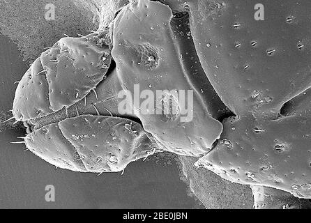 Scanning Electron Micrograph (SEM) showing the dorsal view of a Dermacentor variabilis. D. variabilis, also known as the American dog tick or wood tick, is a species of tick that is known to carry bacteria responsible for several diseases in humans, including Rocky Mountain spotted fever and tularemia (Francisella tularensis). It is one of the most well-known hard ticks. Diseases are spread when it sucks blood from the host, which could take several days for the host to experience some symptoms. Magnification: 98x. Stock Photo