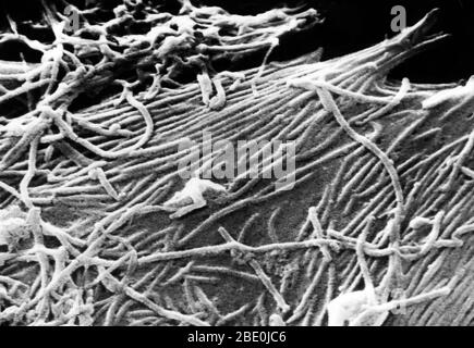 Scanning Electron Micrograph (SEM) of the Ebola virus. The virus was named after a river in the Democratid Republic of the Congo where it was first discovered in 1976. It is an RNA virus (of the family Filoviridae) known to cause the often fatal disease Ebola hemorragic fever (Ebola HF) in primates. Ebola virus (EBOV, formerly designated Zaire ebolavirus) is one of five known viruses within the genus Ebolavirus. Four of the five known ebolaviruses, including EBOV, cause a severe and often fatal hemorrhagic fever in humans and other mammals, known as Ebola virus disease (EVD). Ebola virus has c Stock Photo