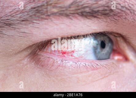 Close-up eye with red bloodshot capillary and veins Stock Photo