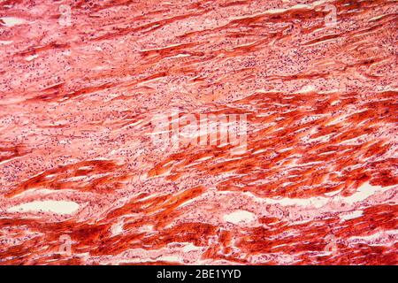 Cyst of the ovarian tissue 100x Stock Photo