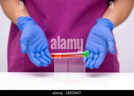 Doctor holding a positive blood test result for the new rapidly spreading Coronavirus. Stock Photo