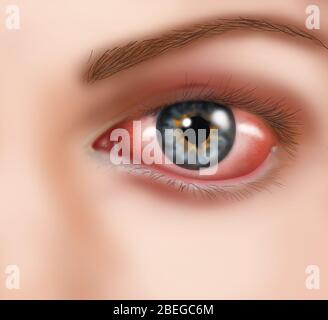 Conjunctiva Illustration Stock Photo - Alamy