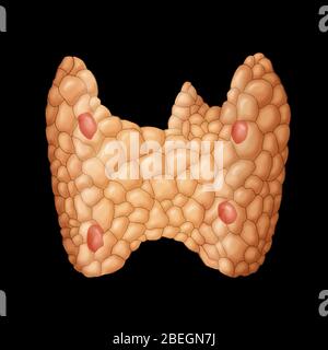 Parathyroid in Thyroid Gland Stock Photo