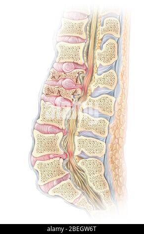 Lumbar Compression Fracture Stock Photo - Alamy