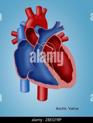 Illustration Of An Open And Closed Normal Aortic Valve (above) Compared 