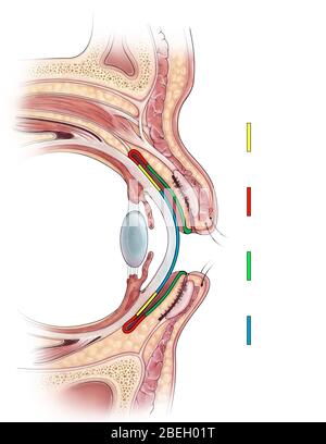 conjuntiva bulbar