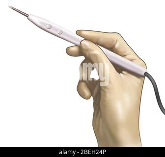 Cautery Knife Stock Photo