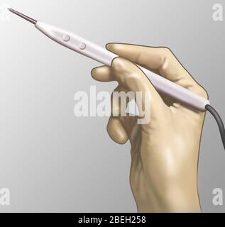 Cautery Knife Stock Photo