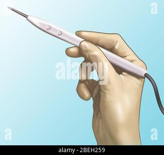 Cautery Knife Stock Photo