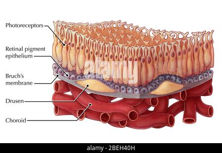 Dry AMD, Illustration Stock Photo