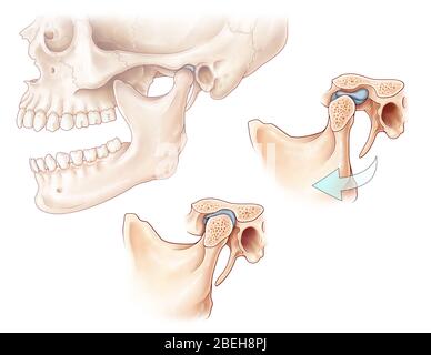 Temporomandibular Joint, Illustration Stock Photo