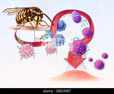 Allergy Development, illustration Stock Photo