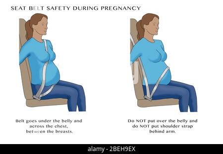 Seat belt safety for pregnant woman. Illustration. Stock Photo