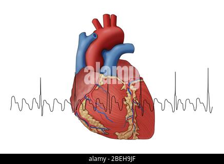 Atrial Flutter with EKG, Illustration Stock Photo - Alamy