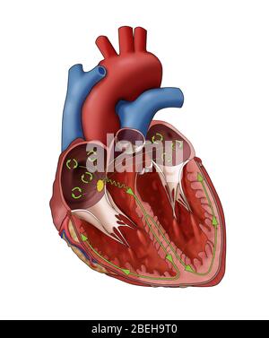 Atrial Fibrillation, Illustration Stock Photo