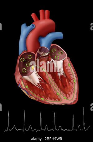 Atrial Fibrillation with EKG, Illustration Stock Photo