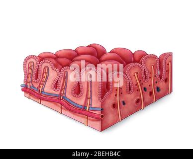 Celiac Disease, Intestinal Villi Stock Photo - Alamy