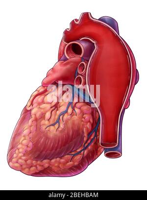 Illustration of an aortic aneurysm Stock Photo - Alamy
