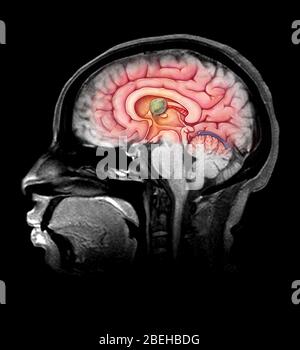 Third brain ventricle, illustration Stock Photo - Alamy