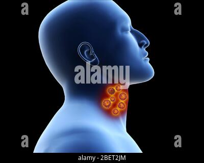 Illustrative concept of coronavirus in the human throat, before entering the lungs. Stock Photo