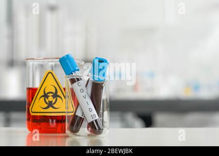 Blood collection tubes from covid 19 patients on a white laboratory table. Coronavirus disease 2019 testing process in a laboratory. Stock Photo