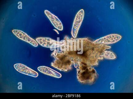 ciliophora paramecium