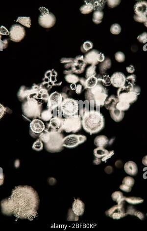 Radiolaria marine animals under the microscope 100x Stock Photo