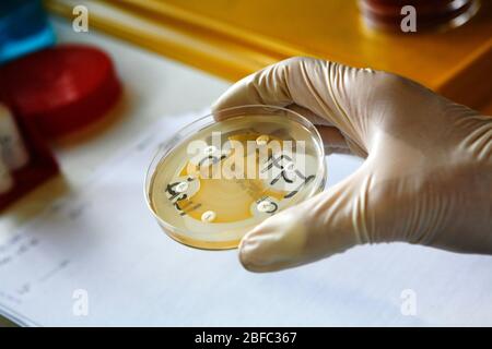 Examining bacterial cultures in a Petri dish Stock Photo