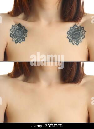 tattoo on woman collarbones laser tattoo removal concept 2bfmtcd
