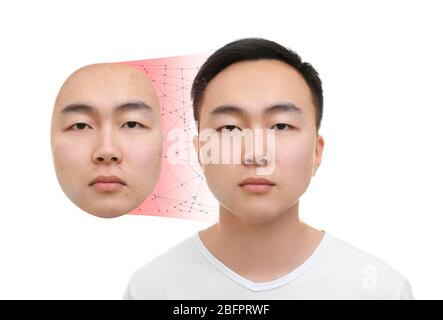 Young man before and after acne treatment on white background. Skin care concept Stock Photo