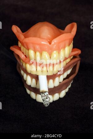 Four sets of dentures with a cigarette in between the teeth. Dentures or false teeth are made from an acrylic base on which acrylic or ceramic teeth a Stock Photo