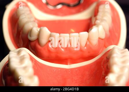 Close up of a set of dentures. Dentures or false teeth are made from an acrylic base on which acrylic or ceramic teeth are mounted. Dentures are custo Stock Photo