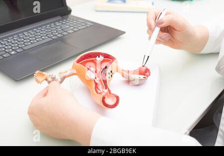 Gynecologist showing uterine structure on a uterus model. Uterus model on gynecologist's desk close-up Stock Photo