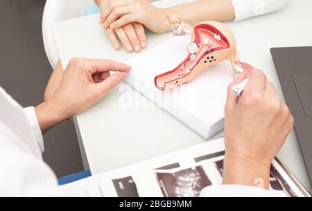 Gynecology, women's health. Close-up of a uterus model Stock Photo