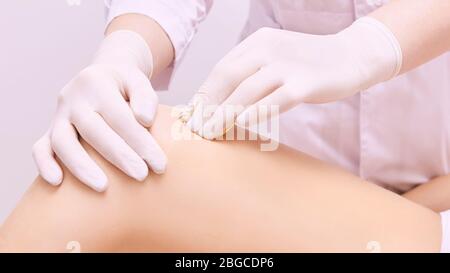 Hair removal at spa luxury studio. Woman legs wax with shugaring. Hot sugar Stock Photo