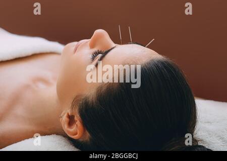 Beautiful woman received an acupuncture procedure in a spa salon. Acupuncture in the face and forehead. Acupuncture needles close-up on a brown backgr Stock Photo