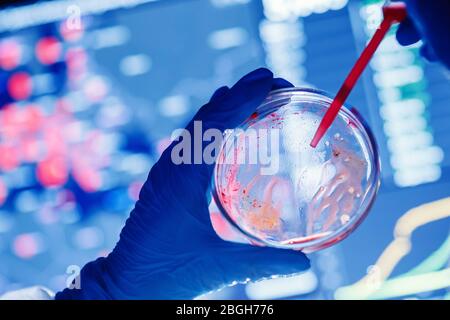 Analysis number infected people in world from 2019-ncov coronavirus, doctor in protective chemical suit with respirator computer in laboratory Stock Photo