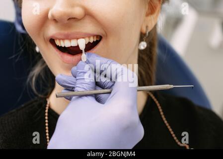 Dentist doctor in purple medical gloves applying sample from tooth enamel scale to smiling woman patient teeth to pick up right shade, teeth bleaching procedure. Close up. Stock Photo