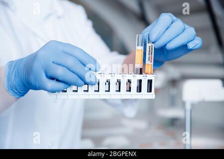 Bioengineer holds test tubes of blood samples for DNA analysis and presence of virus in cytoplasm, blurred background Stock Photo