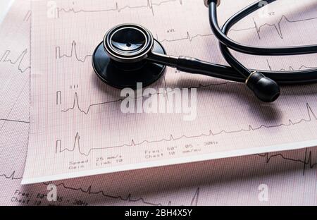 Stethoscope on electrocardiogram Stock Photo