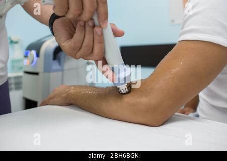 https://l450v.alamy.com/450v/2bh6bgk/procedure-shock-wave-therapy-at-clinic-physiotherapist-treatment-pain-on-the-arm-with-shock-wave-equipment-2bh6bgk.jpg